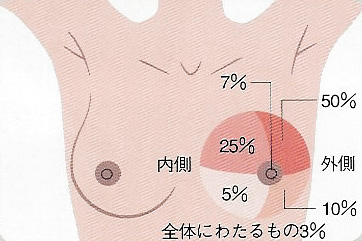 乳がん検診 表2