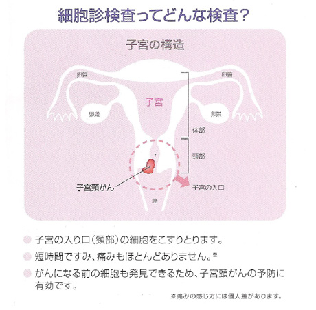 子宮頚がん検査 表1